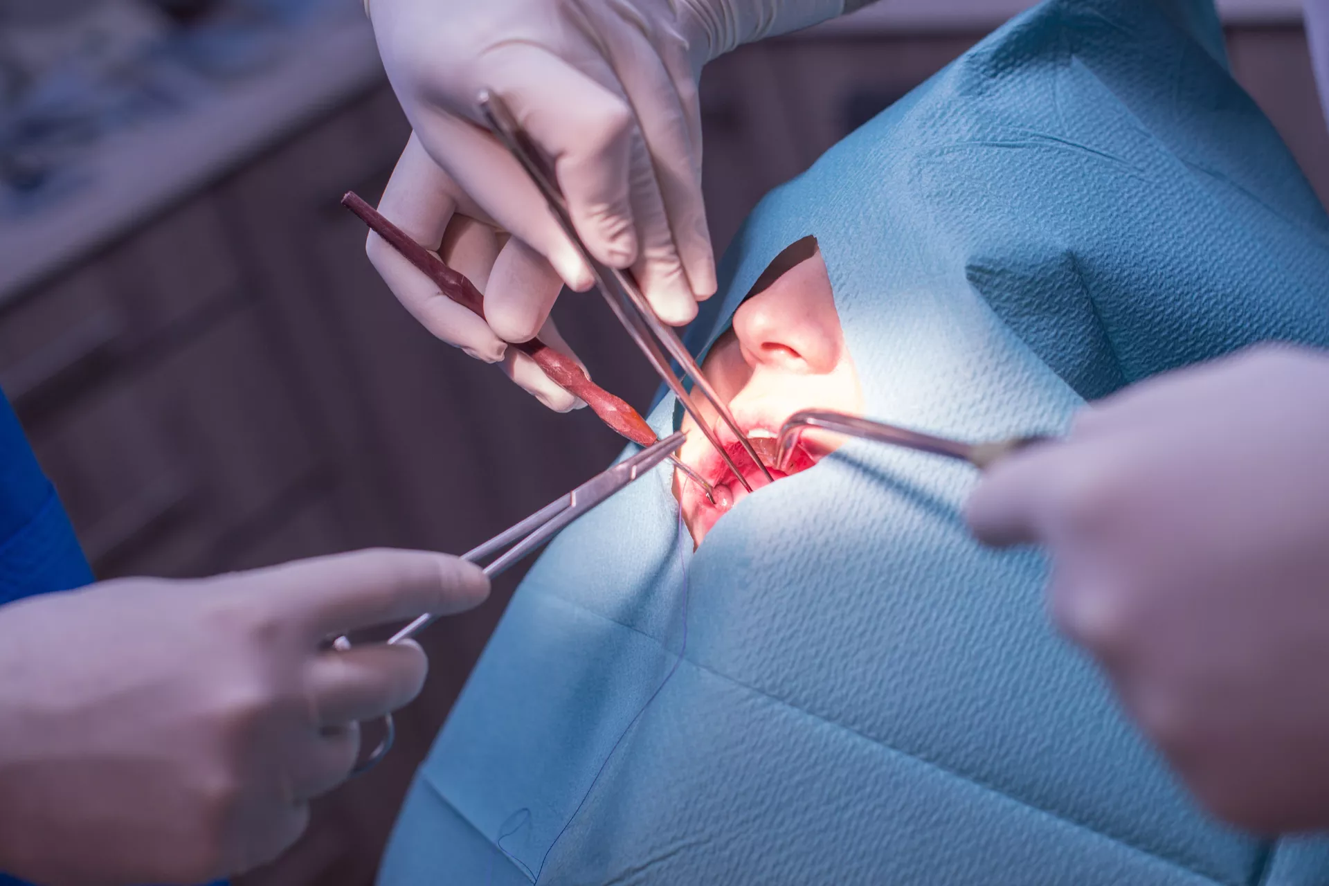 Chirurgie Dento Alveolara Tecuci